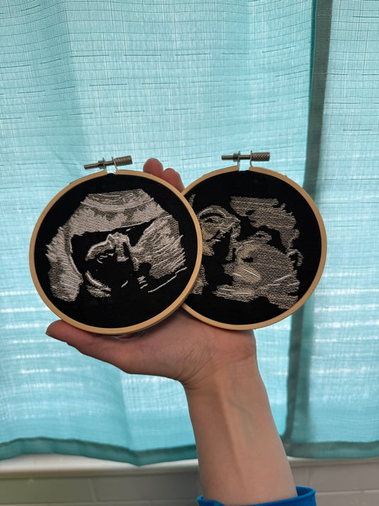 Custom Embroidered Ultrasound